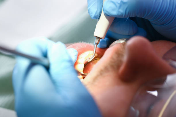 Best Emergency Treatment for Toothache in Old Mystic, CT